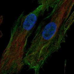 HTRA1/PRSS11 Antibody, Novus Biologicals 25 &mu;L; Unlabeled:Antibodies,